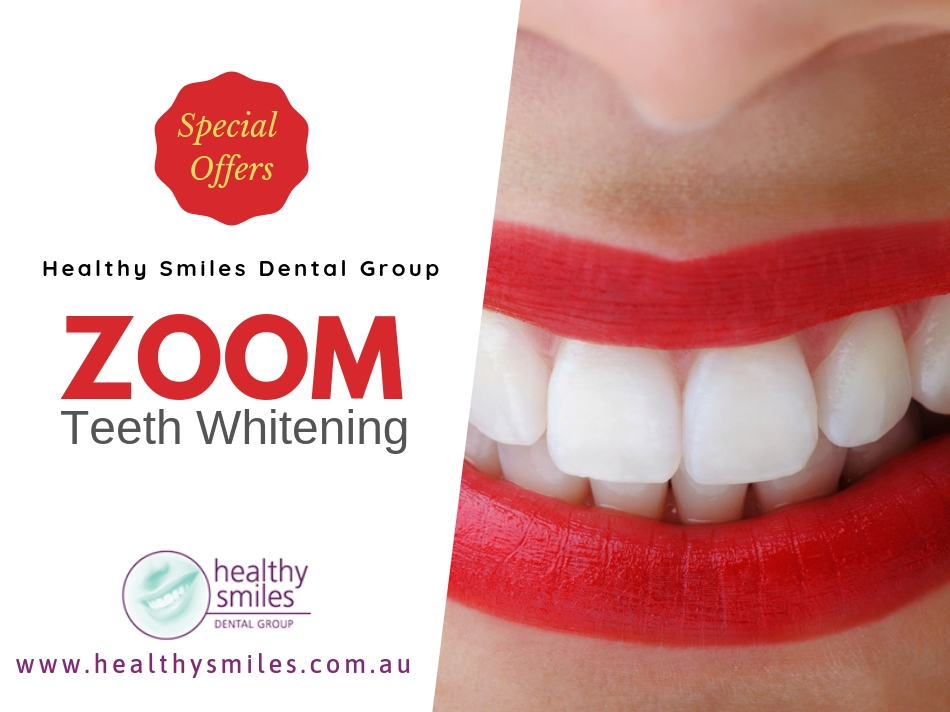 Zoom Teeth Whitening Special Offers - Healthy Smiles