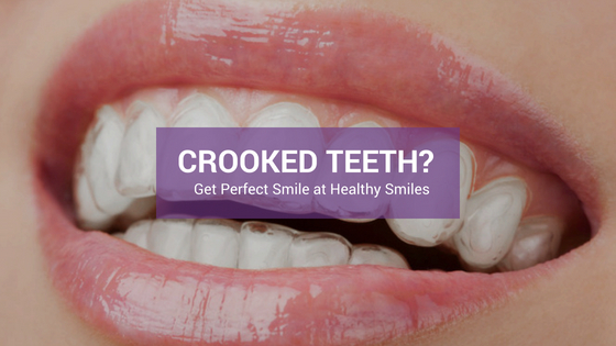 Crooked Teeth and Their Influence on your Smile, Bite and Confidence
