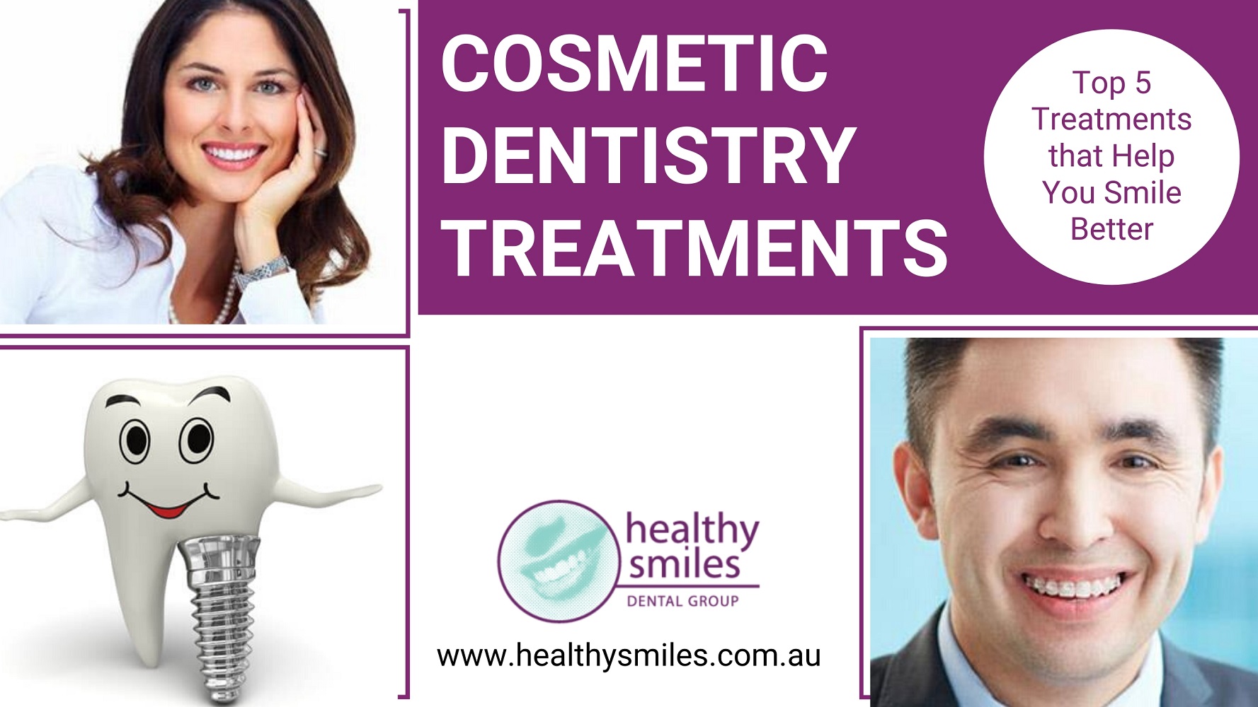 Top 5 Cosmetic Dentistry Treatments that Help You Smile Confidently