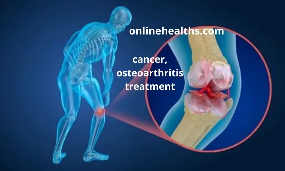 Buy Tramadol Online for cancer, osteoarthritis