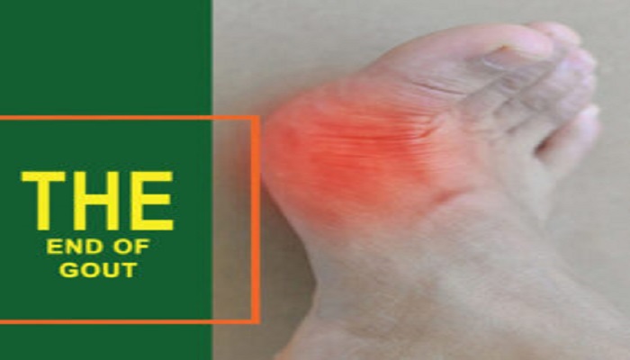 Gout Symptoms Treatment Program Reviews