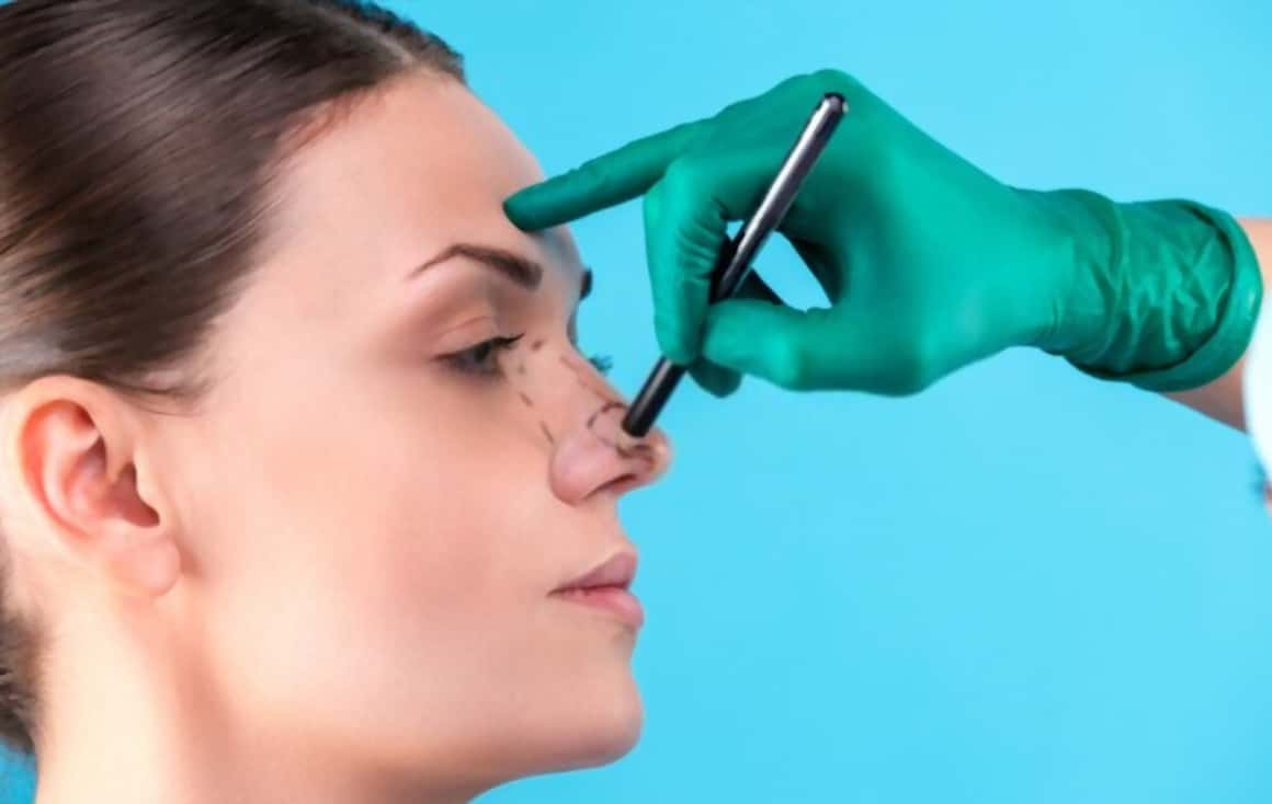 WHAT ARE THE QUALITIES OF A GOOD RHINOPLASTY SURGEON?