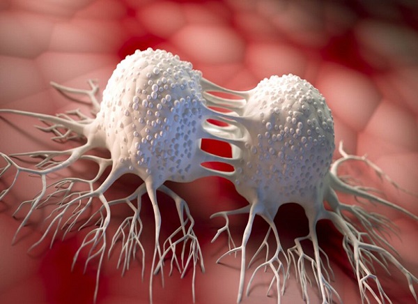 Choosing the Most Effective Cancer Treatment in Kennewick