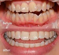 Best Austin Tex. Dentistry | Cloud Dental