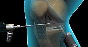 Seek for A Reputed Orthopaedic Surgeon
