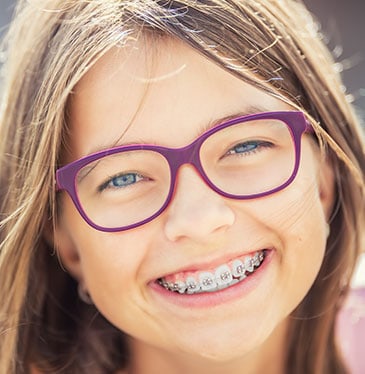 Reasons Why You Need to Get Clear Braces