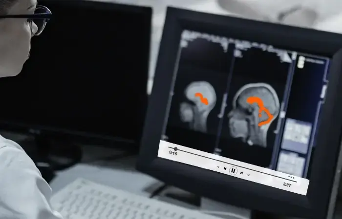 The Importance of Medical Data Annotation Services for Modern Healthcare