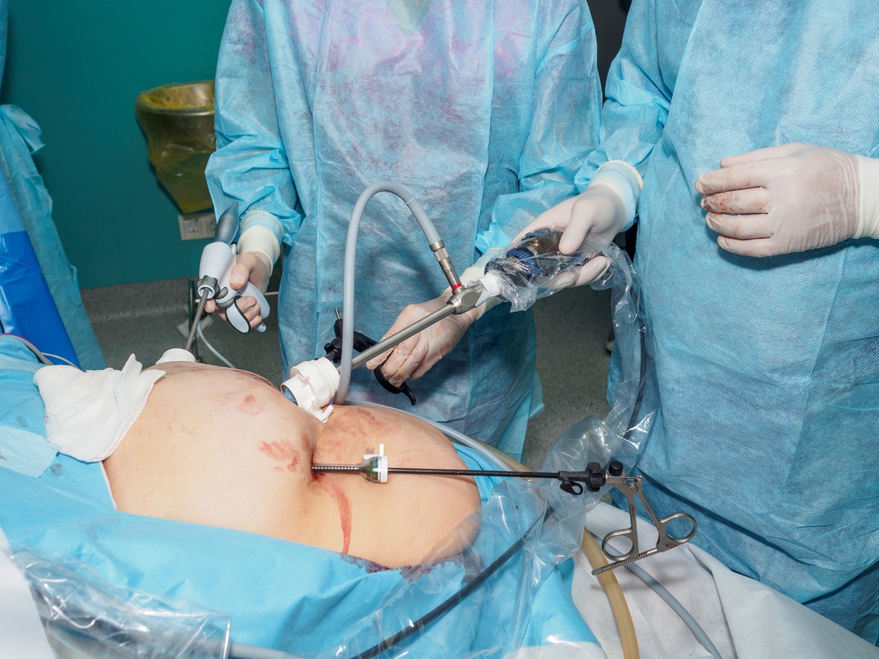 Which Is The Best Laparoscopic Surgeon In Haryana | Dr Meenakshi Goyal