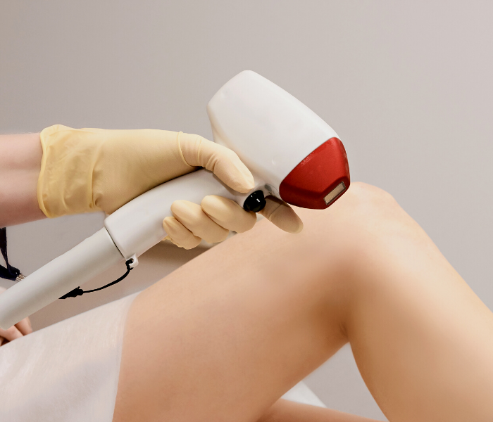 Advantages of Permanent Laser Hair Removal