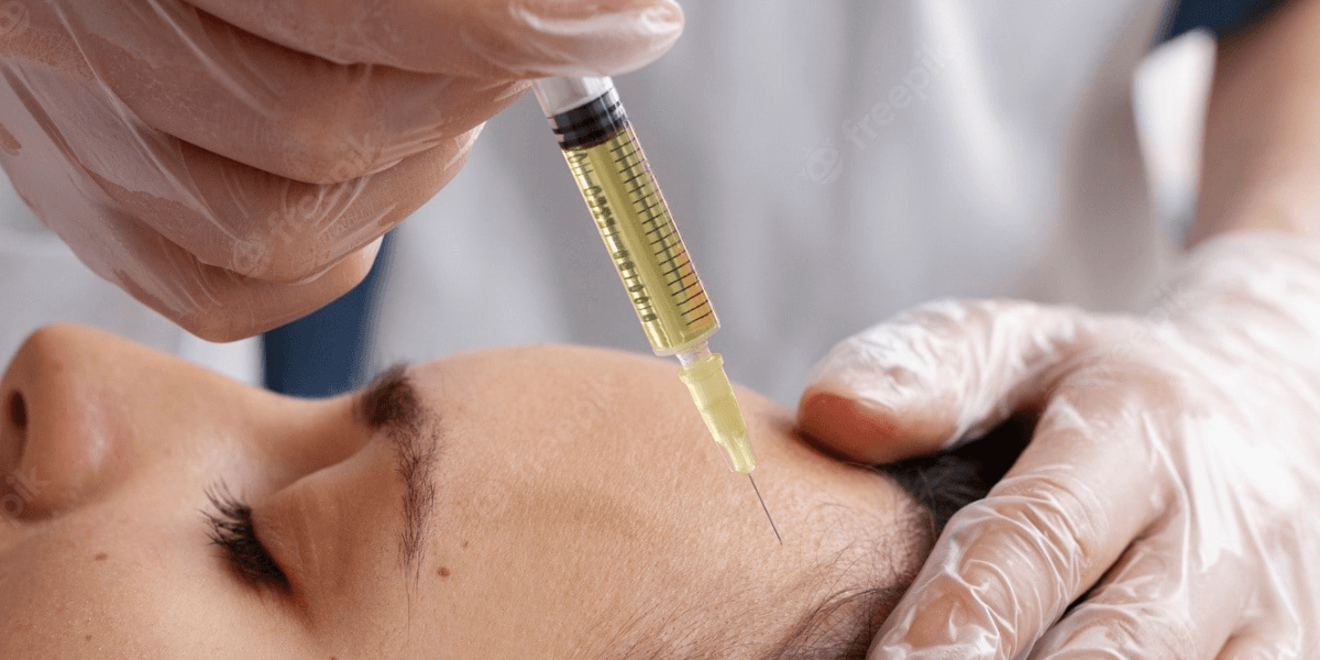 Beyond the Scalp: Platelet-Rich Plasma Therapy for Comprehensive Hair Wellness