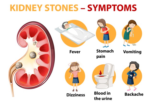 3 Symptoms Your Back Pain is due to Kidney Stones