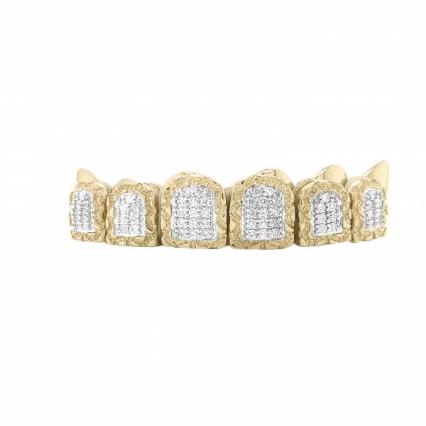 Teeth Grillz Best Place - Exotic Diamonds