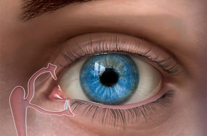 What to Do After a Tear Duct Surgery