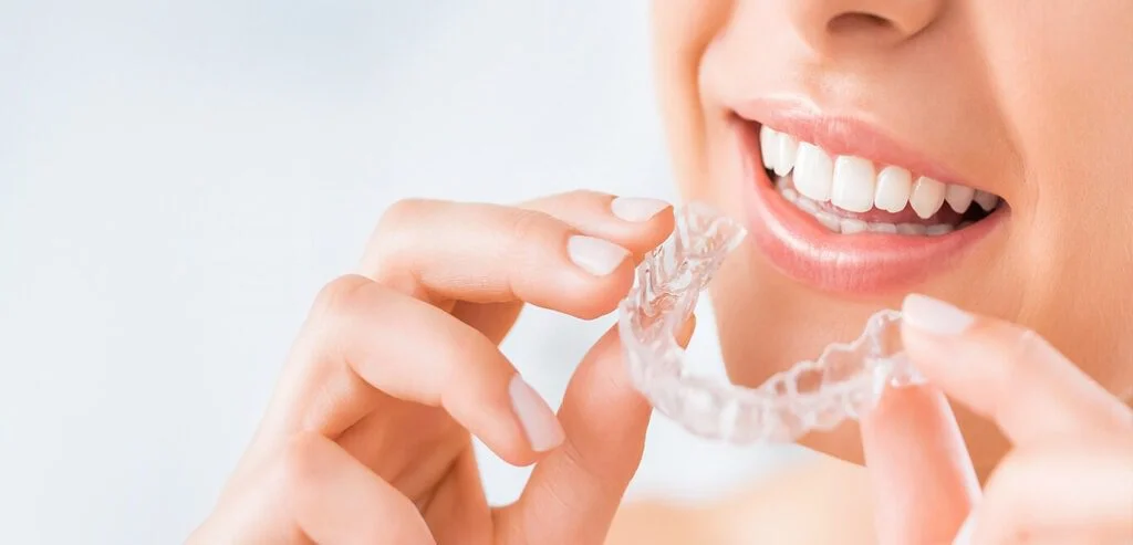  Smile in Confidence: Discover the Benefits for Orthodontic Treatment in Charlotte