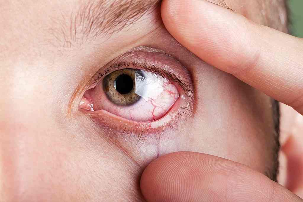 Common Eye Diseases: Understand It, Detect It and Live Better