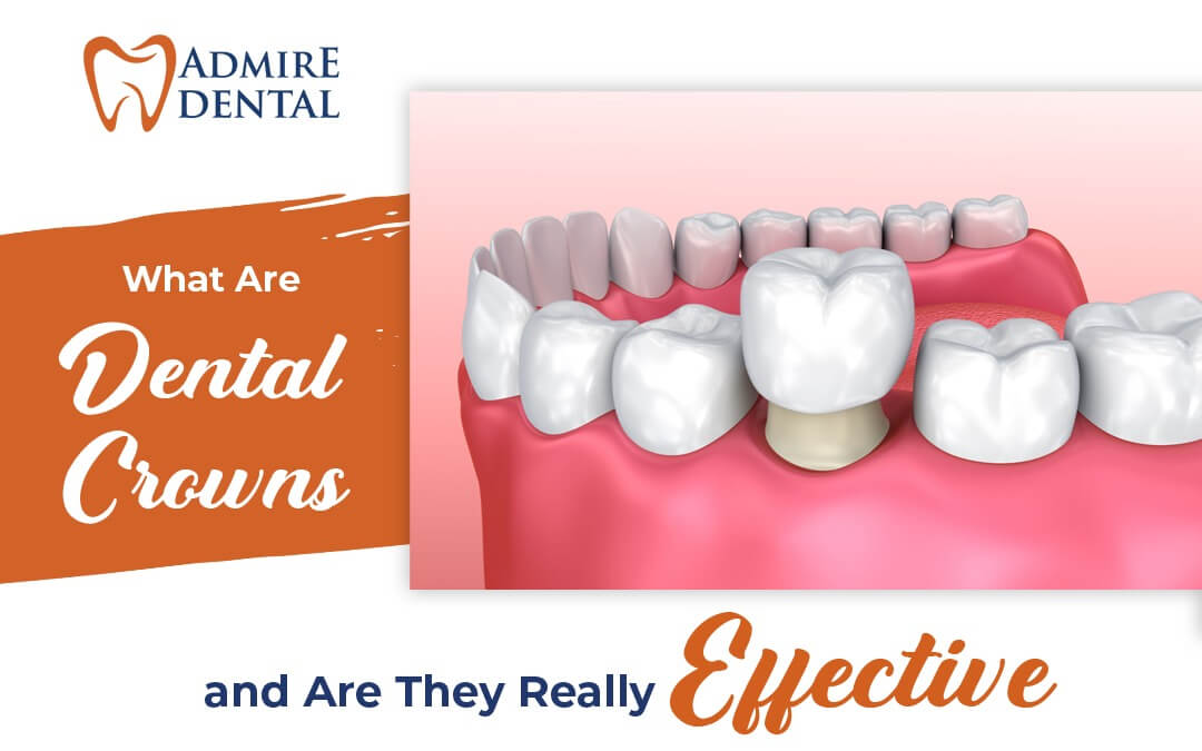 What is a Dental Crown and Are They Really Effective?