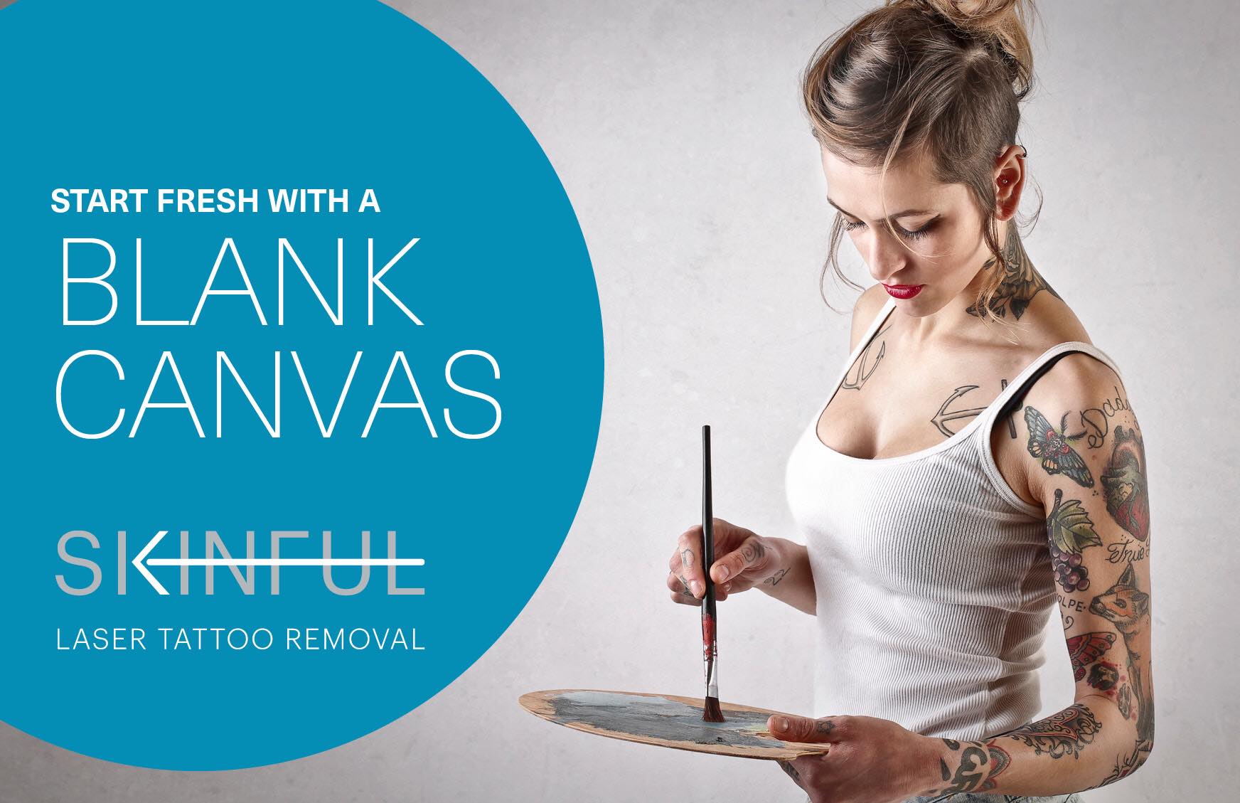 Laser Tattoo Removal: Know Its Benefits and Risks