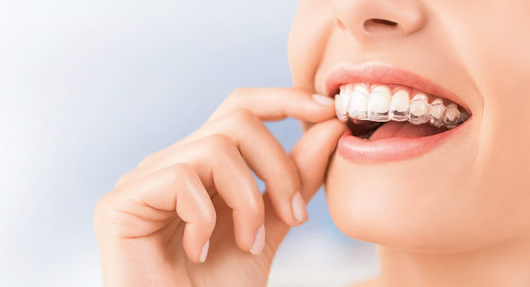 Do you have any orthodontic issues? Get treatment from an orthodontist for a healthy smile.