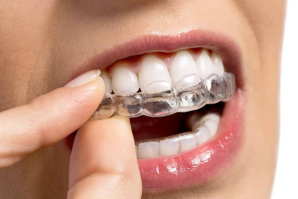Invisalign: The Fast, Invisible, and Comfortable Way to Straighten Teeth