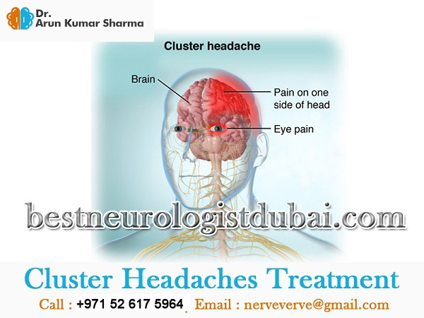Best neurologist in Dubai 