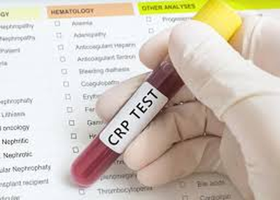 Global C-Reactive Protein Testing Market: Future Trends and Best Regions to Focus Globally!