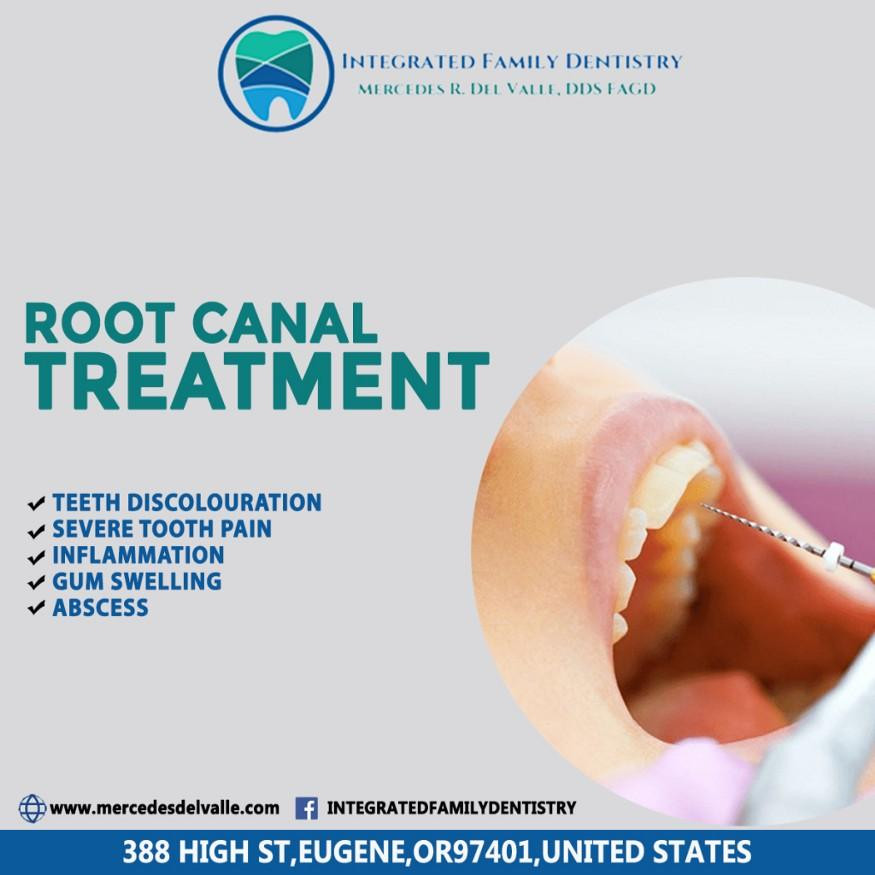Root Canal Eugene Orgon – Endodontist near me Eugene | mercedesdelvalle