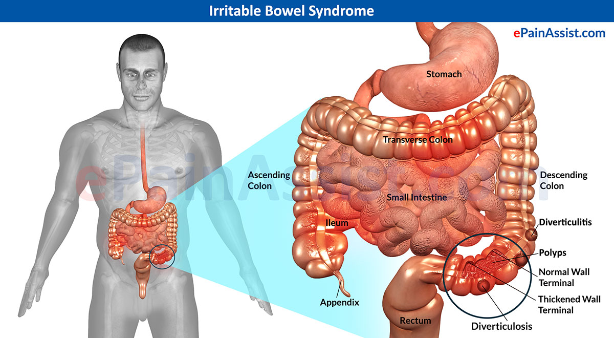 Irritable Bowel Syndrome Drugs Market Growth to Witness a Surge by Rise in Prevalence of the Disease with a Notable CAGR during 2020 – 2029
