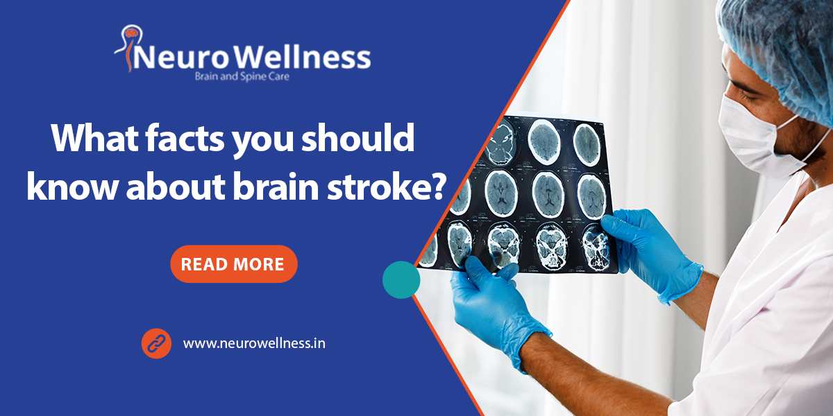 What facts you should know about brain stroke?