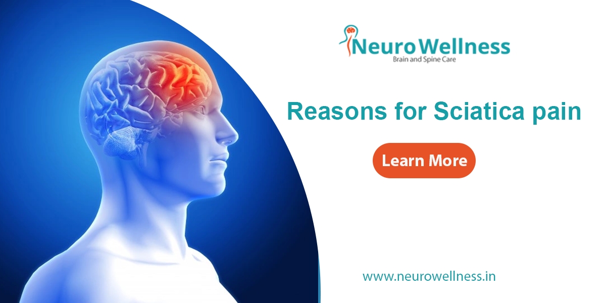 Reasons for Sciatica Pain