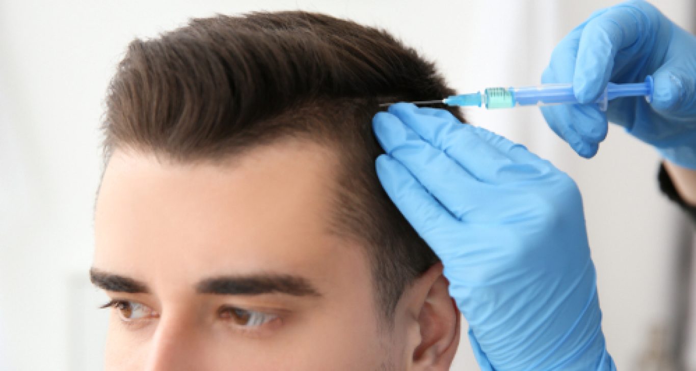Male Pattern Baldness: Facts And Treatment