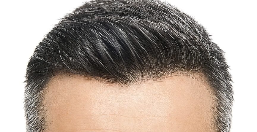 How To Increase The Hair Growth Rate After Hair Transplant?