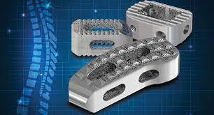Orthopedic Composite Market Size, Share, Growth, Opportunities and Global Forecast to 2027