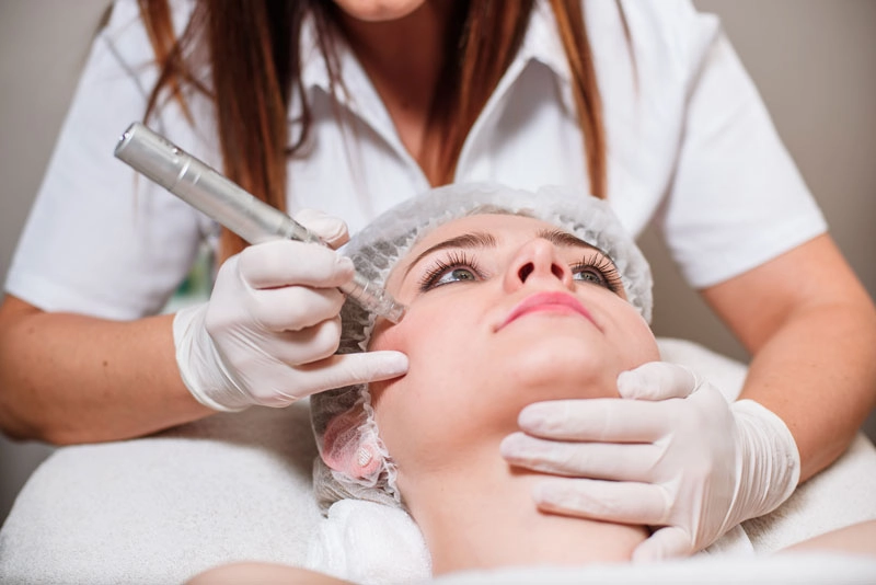 Benefits Of Laser Skin Treatment