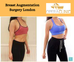 Breast Augmentation Surgery London