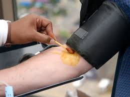 Global Povidone Iodine Market 2020 - Top Key Players Analysis Report Till 2027