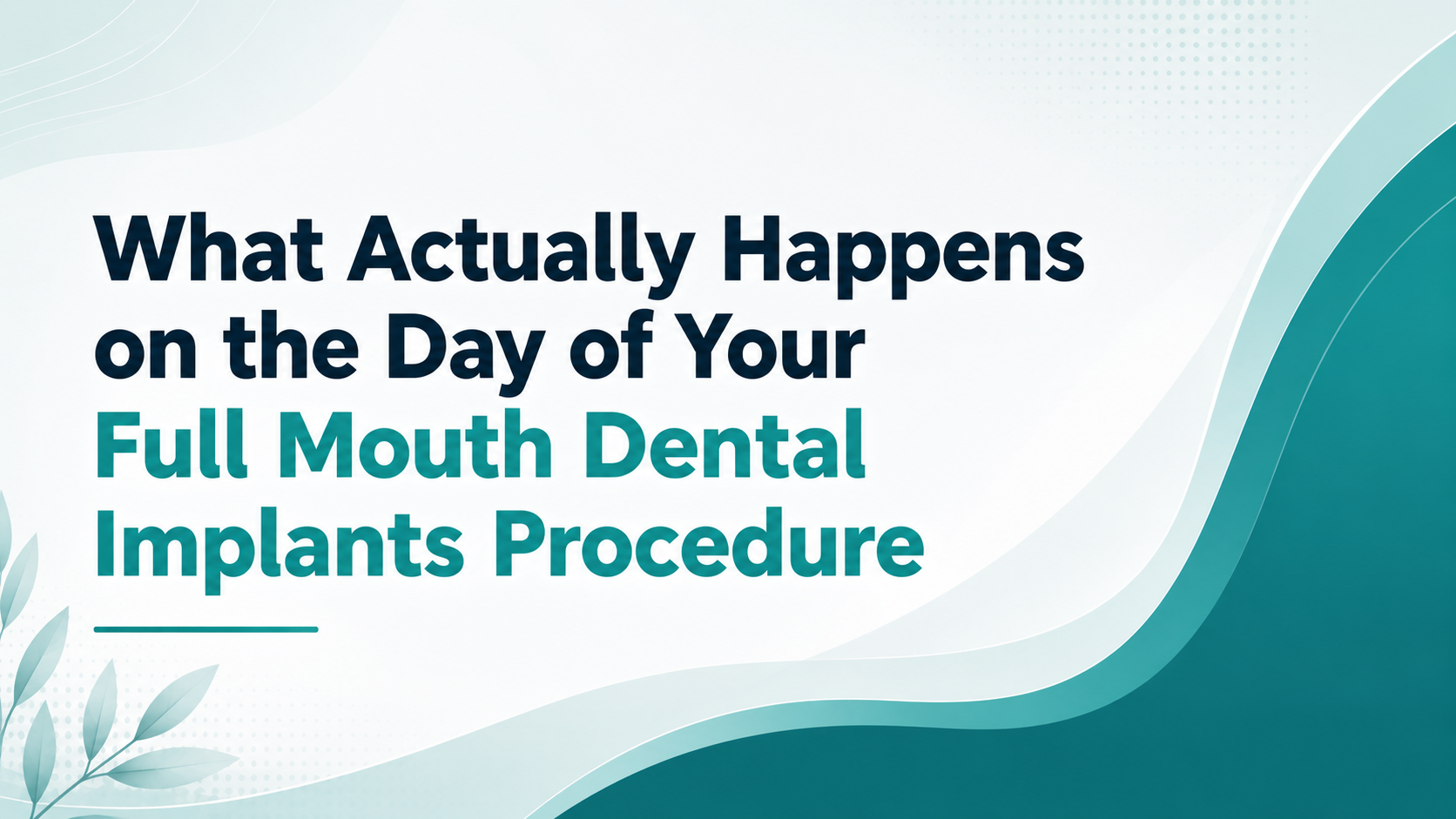 What Actually Happens on the Day of Your Full Mouth Dental Implants Procedure