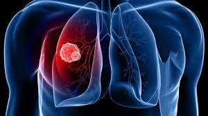 Cancer/Tumor Profiling Market | Global Industry Trends, Segmentation, Business Opportunities & Forecast To 2027
