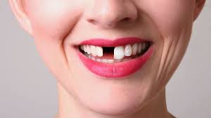 Emergency Dental Care Services in London