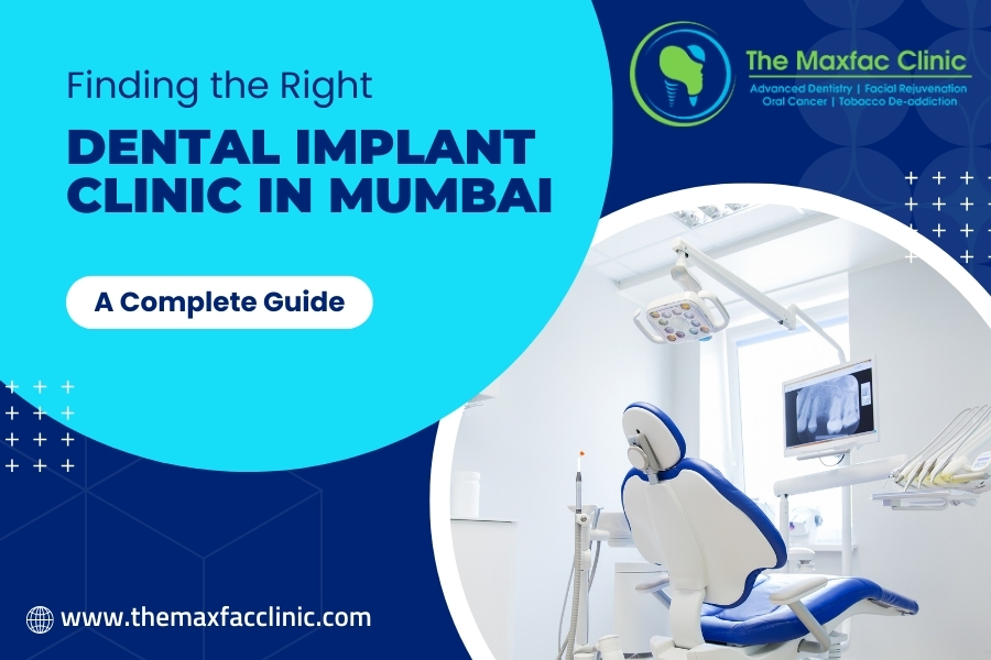 Finding the Right Dental Implant Clinic in Mumbai: A Complete Guide