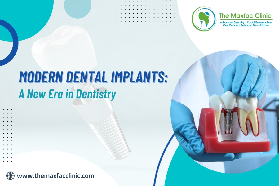 Modern Dental Implants: A New Era in Dentistry