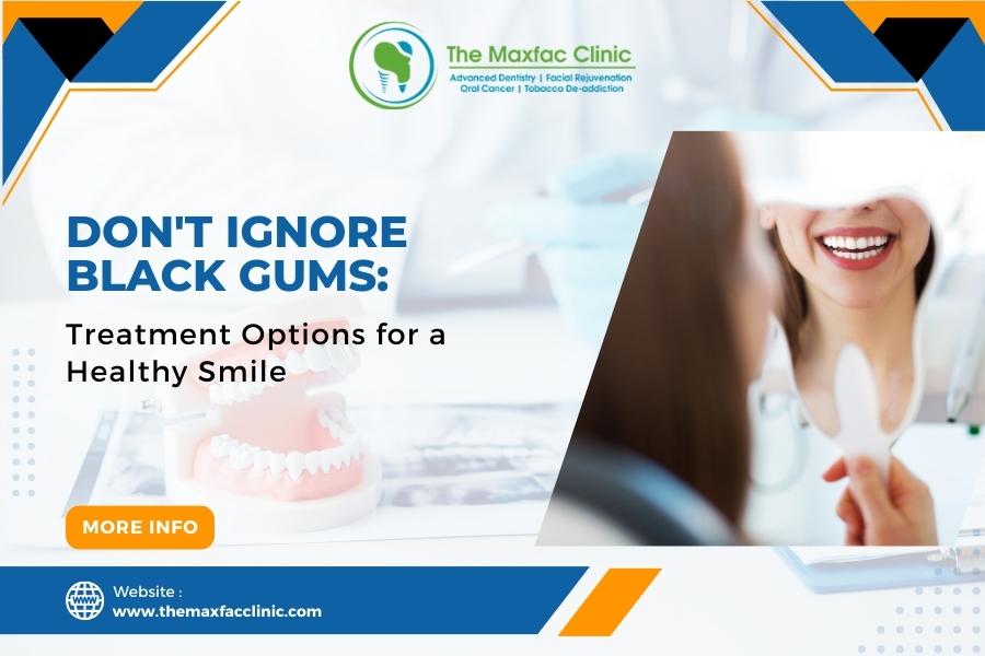 Don't Ignore Black Gums: Treatment Options for a Healthy Smile