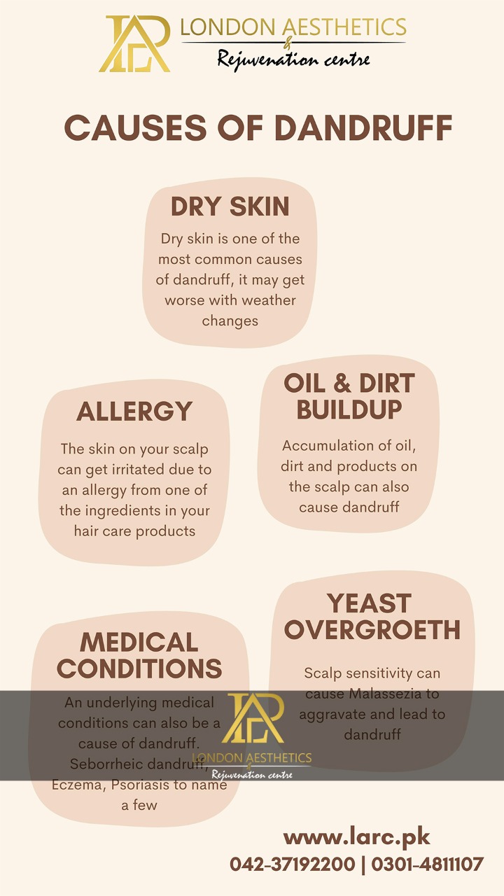 Causes of dandruff