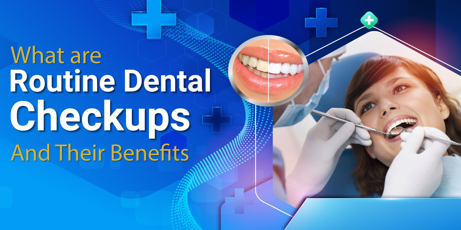 What are Routine Dental Checkups and Their Benefits