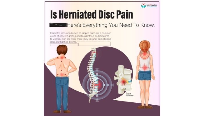 Herniated Disc Diagnosed & Prevention