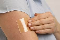 Transdermal Skin Patches Market Size, Status, Growth | Industry Analysis Report 2020-2027