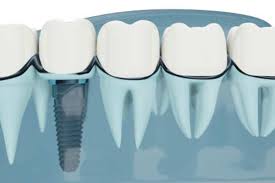 Smart CBCT Market Size, In-depth Analysis Report and Global Forecast to 2027