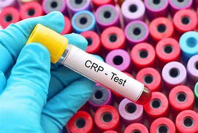 Global Cardiac Biomarkers Market 2021 Analysis Report by Recent Developments and Emerging Technologies Till 2027