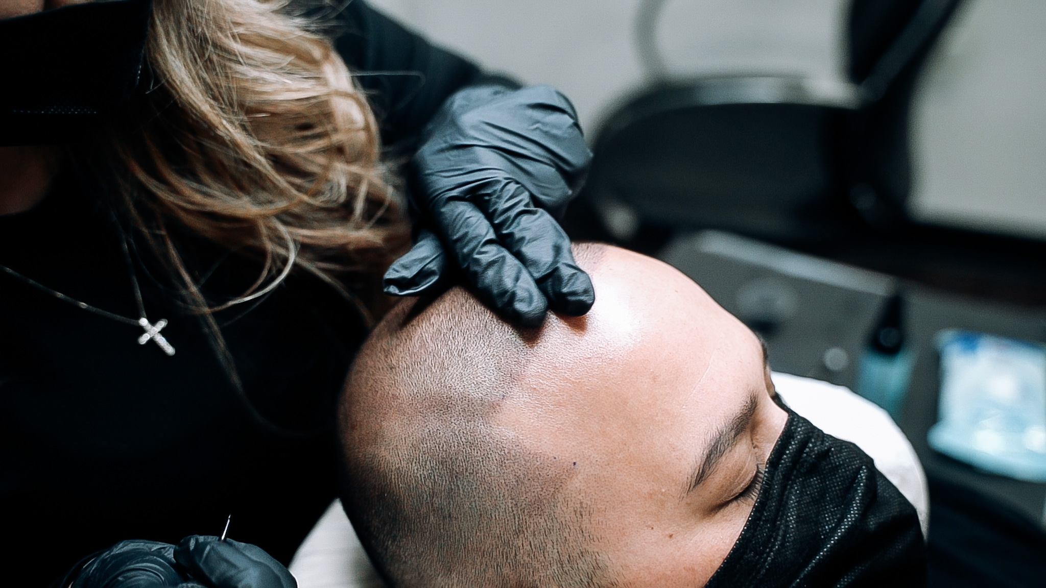 Best Scalp Micropigmentation In California, USA | PGMNT.FX