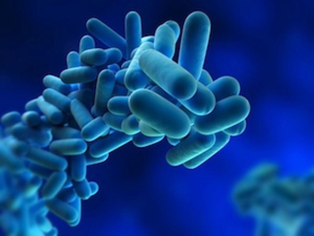 Legionella risk Training