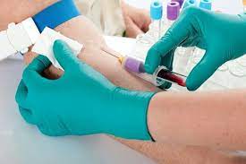 Blood Viscometer Market Size, In-depth Analysis Report and Global Forecast to 2027